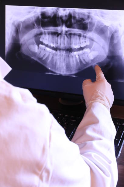 Best Emergency Dental Care for Broken or Chipped Teeth in Morgans Point Resort, TX